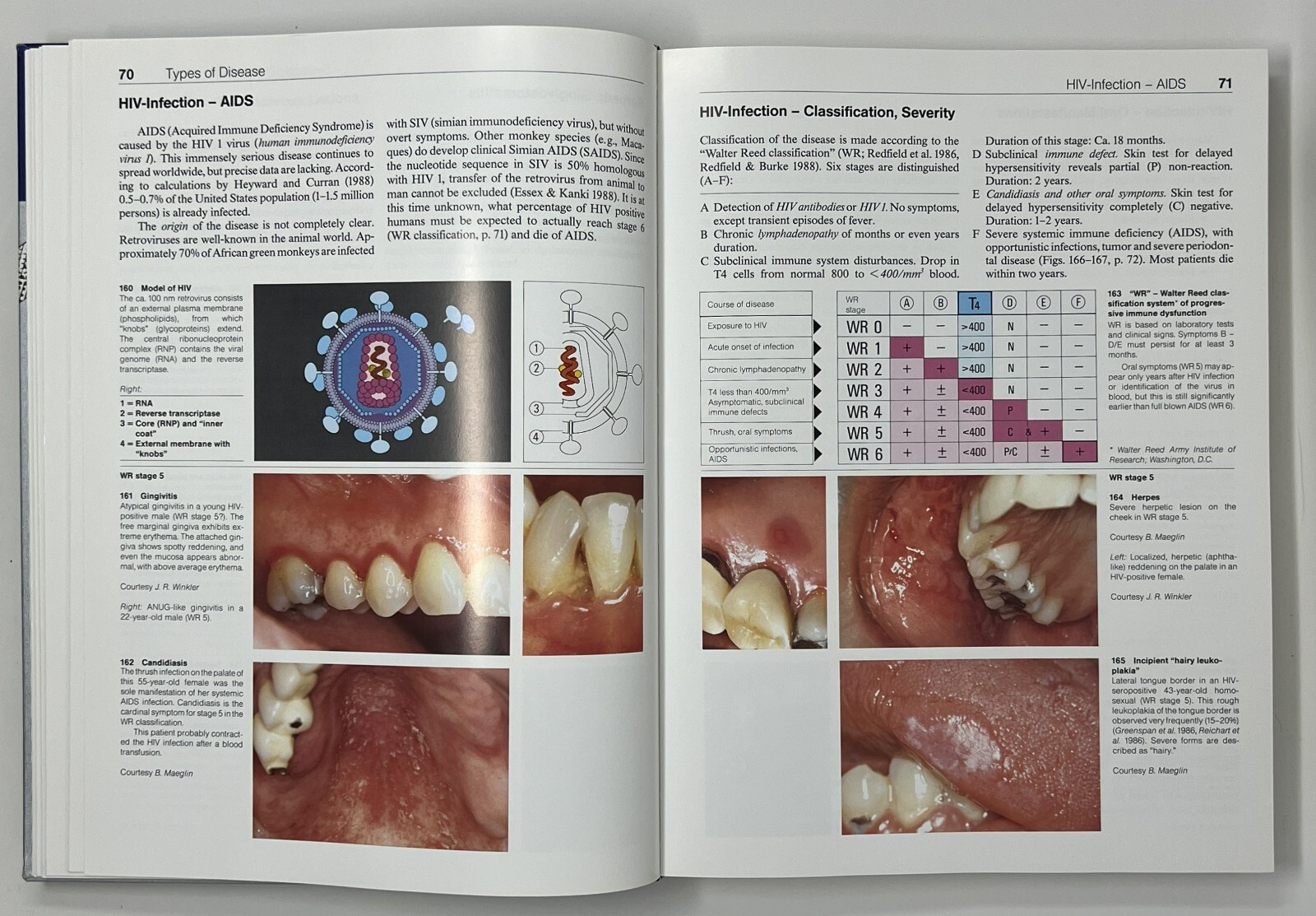 Color Atlas of Dental Medicine: Periodontology by Rateitschak, Wolf & Hassell HC